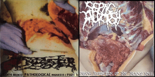 Infester (USA-2) : Septic Autopsy - Infester